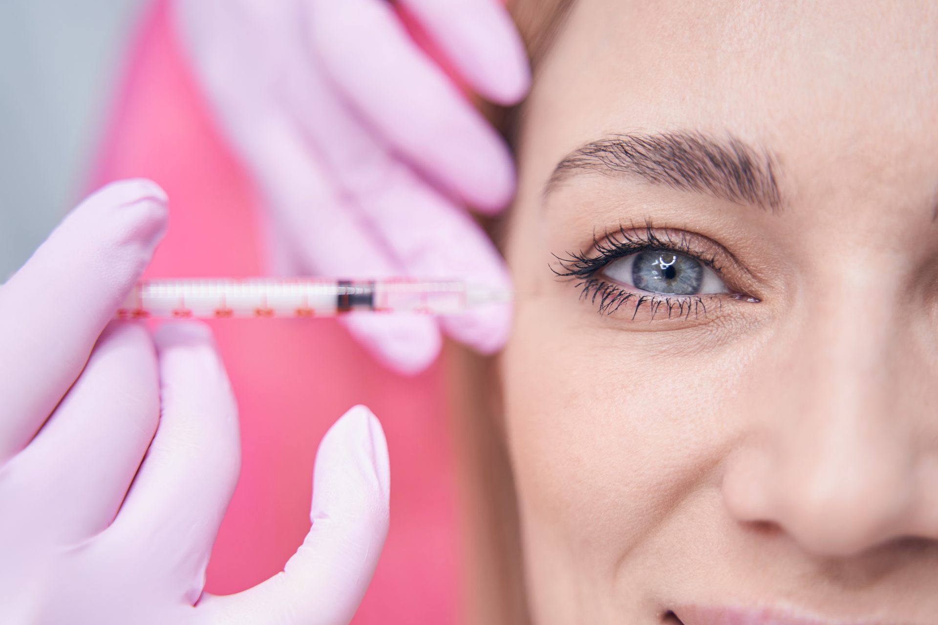 Cosmetic injection treatment for the lines around the eyes