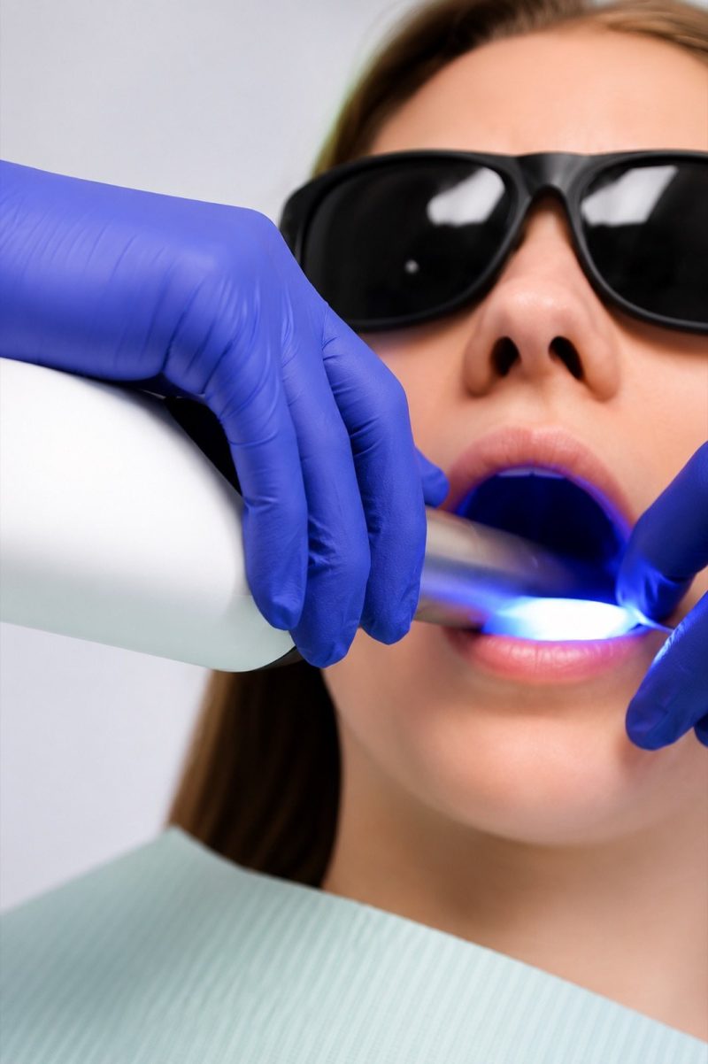 Teeth whitening treatment at Genesis Dental Centre
